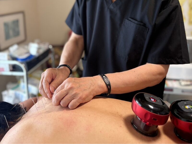 院長が上海で修得！「本場・中医学」に基づく根本鍼灸